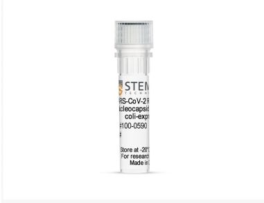 重组SARS-CoV-2核衣壳蛋白aa1-419（大肠杆菌表达）